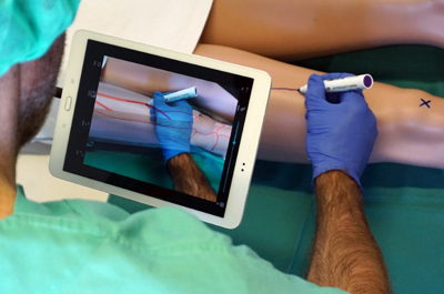 Unterstützung des Chirurgen bei Operationsvorbereitung durch Augmented Reality